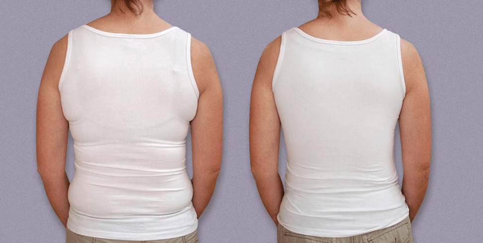 The Truth About Shapewear: Does Wearing Shapewear Help Tighten Skin - Shapeez