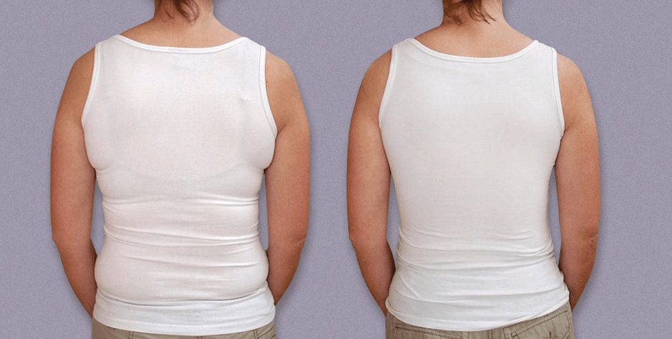 Posture corrector Vest body shaper - Post surgery Body shapers and